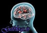 چسب ضد آلزایمر میآید